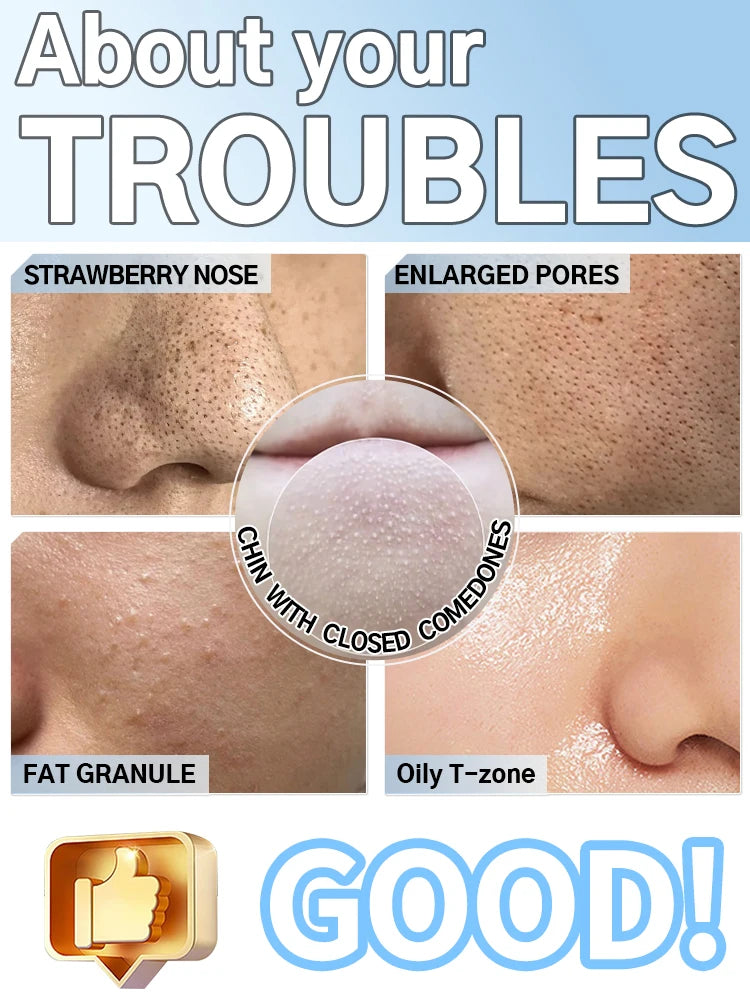 powerful blackhead removed