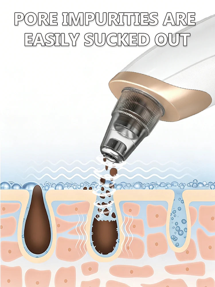 powerful blackhead removed